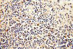 MRPS15 Antibody in Immunohistochemistry (Paraffin) (IHC (P))