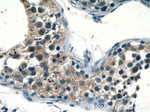 RECQL4 Antibody in Immunohistochemistry (Paraffin) (IHC (P))