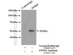 PPM1F Antibody in Immunoprecipitation (IP)