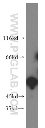 PPM1F Antibody in Western Blot (WB)