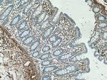 Collagen Type VI Antibody in Immunohistochemistry (Paraffin) (IHC (P))