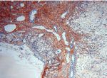 Collagen Type VI Antibody in Immunohistochemistry (Paraffin) (IHC (P))