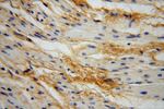 Collagen Type VI Antibody in Immunohistochemistry (Paraffin) (IHC (P))