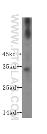 ROGDI Antibody in Western Blot (WB)