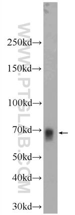 NFE2L1 Antibody in Western Blot (WB)