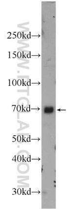 NFE2L1 Antibody in Western Blot (WB)