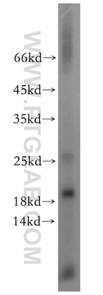 EIF5A2 Antibody in Western Blot (WB)