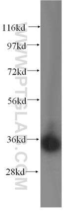 LZTFL1 Antibody in Western Blot (WB)