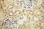 TBC1D5 Antibody in Immunohistochemistry (Paraffin) (IHC (P))