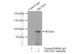 TBC1D5 Antibody in Immunoprecipitation (IP)