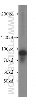 TBC1D5 Antibody in Western Blot (WB)