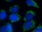 LARS2 Antibody in Immunocytochemistry (ICC/IF)