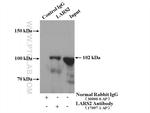 LARS2 Antibody in Immunoprecipitation (IP)