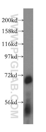 ATP6V1A Antibody in Western Blot (WB)