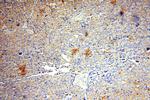 ATP6V1A Antibody in Immunohistochemistry (Paraffin) (IHC (P))