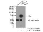 ATP6V1A Antibody in Immunoprecipitation (IP)