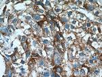 ACSS1 Antibody in Immunohistochemistry (Paraffin) (IHC (P))