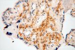 PYCR2 Antibody in Immunohistochemistry (Paraffin) (IHC (P))