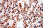 PYCR2 Antibody in Immunohistochemistry (Paraffin) (IHC (P))