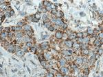 PYCR2 Antibody in Immunohistochemistry (Paraffin) (IHC (P))