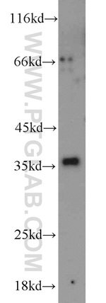 PYCR2 Antibody in Western Blot (WB)