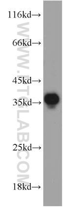 PYCR2 Antibody in Western Blot (WB)