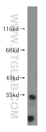 PYCR2 Antibody in Western Blot (WB)