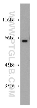 OATP14 Antibody in Western Blot (WB)