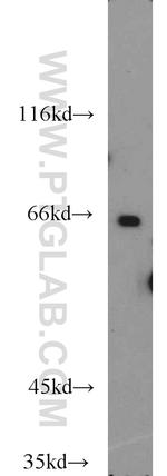 OATP14 Antibody in Western Blot (WB)