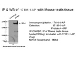 DNMBP Antibody in Immunoprecipitation (IP)