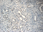 RSPO3 Antibody in Immunohistochemistry (Paraffin) (IHC (P))