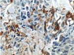 RSPO3 Antibody in Immunohistochemistry (Paraffin) (IHC (P))