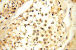 MRPS27 Antibody in Immunohistochemistry (Paraffin) (IHC (P))