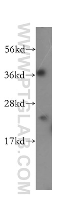 EIF4E3 Antibody in Western Blot (WB)
