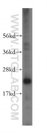 EIF4E3 Antibody in Western Blot (WB)