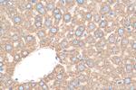 ERLIN1 Antibody in Immunohistochemistry (Paraffin) (IHC (P))