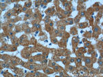 ALDH5A1 Antibody in Immunohistochemistry (Paraffin) (IHC (P))