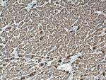 ALDH5A1 Antibody in Immunohistochemistry (Paraffin) (IHC (P))