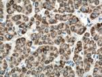 ALDH5A1 Antibody in Immunohistochemistry (Paraffin) (IHC (P))