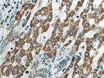 ALDH5A1 Antibody in Immunohistochemistry (Paraffin) (IHC (P))