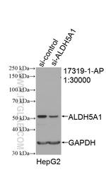 ALDH5A1 Antibody in Western Blot (WB)