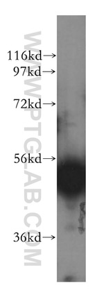 ALDH5A1 Antibody in Western Blot (WB)