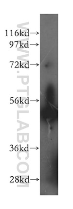 ALDH5A1 Antibody in Western Blot (WB)