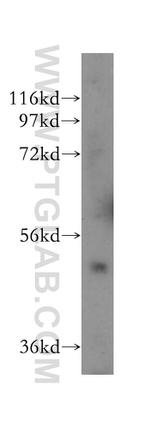 ALDH5A1 Antibody in Western Blot (WB)