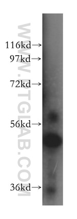 ALDH5A1 Antibody in Western Blot (WB)