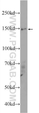 ASTN2 Antibody in Western Blot (WB)