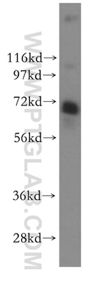 RPAP2 Antibody in Western Blot (WB)