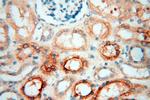 PDCL2 Antibody in Immunohistochemistry (Paraffin) (IHC (P))