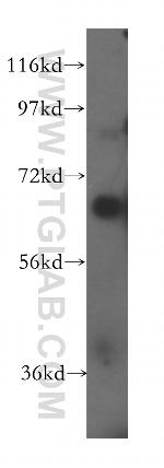 CD33 Antibody in Western Blot (WB)