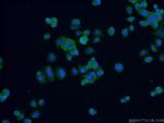 FABP7 Antibody in Immunocytochemistry (ICC/IF)